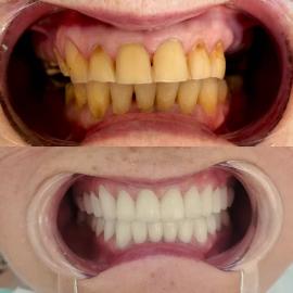 Работы до/после