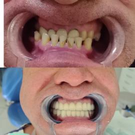 Работы до/после