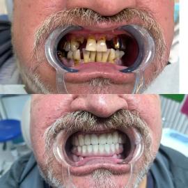 Работы до/после